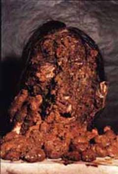 F:\imagens baixa resoluo\fig.3  75 dpi.jpg